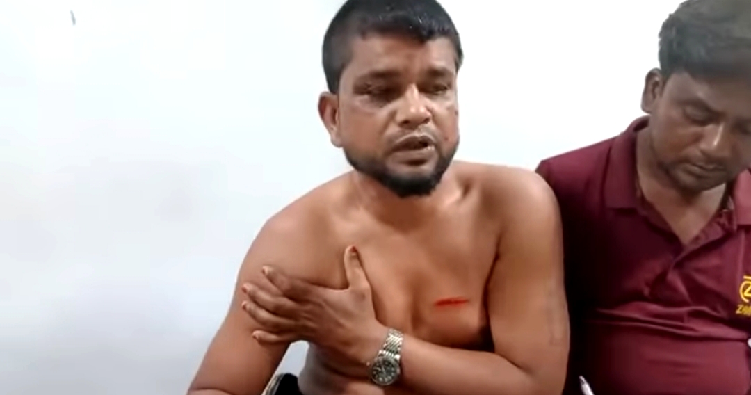 টাঙ্গাইলের করোটিয়াতে সাংবাদিকের উপর ভয়ানক স*ন্ত্রা*সী হা*ম*লা।