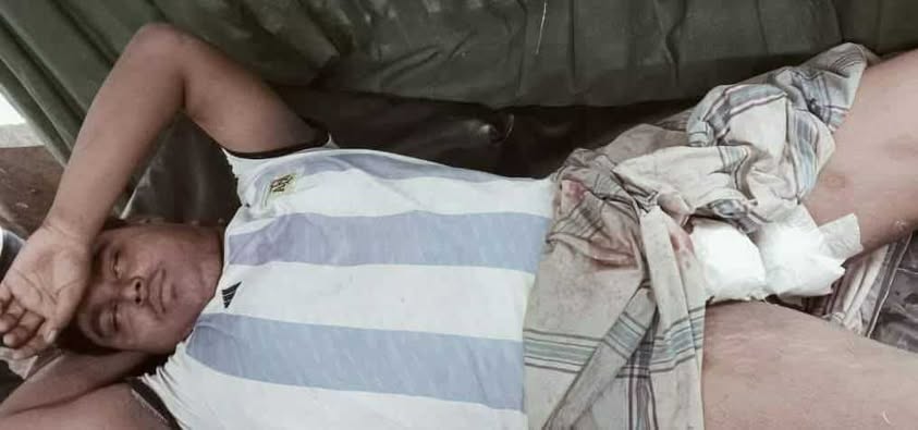 সাদুল্যাপুরের  খোর্দ্দকোমরপুরের নাপিত বাজারে বাকি টাকা চাওয়াকে কেন্দ্র করে  সন্ত্রাসীর গুলিতে মহিলা সহ ২ জন আহত।