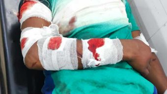 ফুলছড়িতে তাণ্ডব: বিএনপি নেতার বাড়িতে হামলা-ভাঙচুর, ১৩ জনকে পিটিয়ে জখম—জীবন নিয়ে শঙ্কায় পরিবার